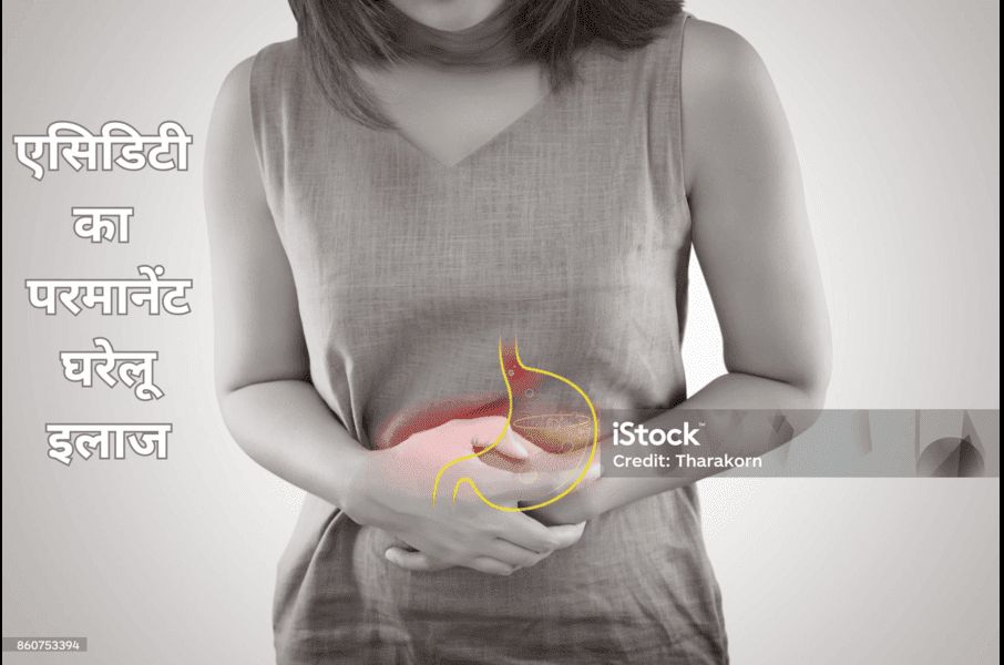 Acity home remedies